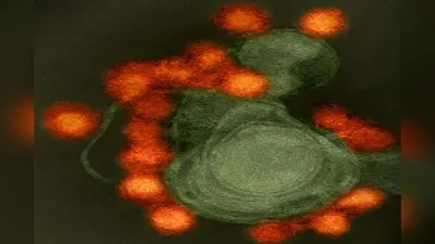 Deadly Virus : यह घातक वायरस करते हैं सीधा दिमाग पर असर, जानिए कौन सा है सबसे ज्यादा खतरनाक?