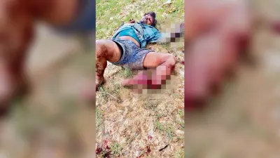 आपसी झगड़े में अपराधियों ने युवक के हाथ और पैर काटे