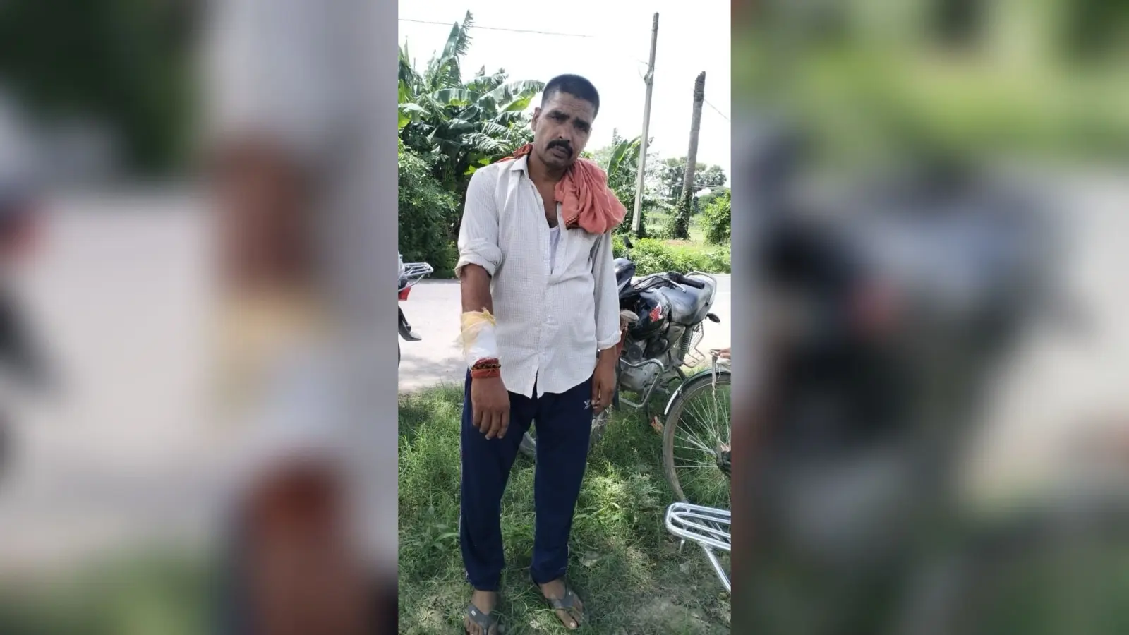 स्कूटी सवार बदमाशों ने होमगार्ड जवान को जख्मी कर लूटी बाइक