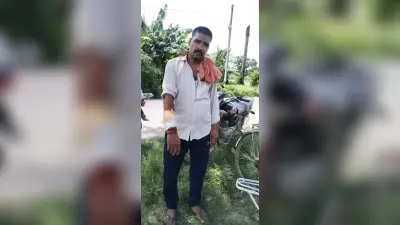 स्कूटी सवार बदमाशों ने होमगार्ड जवान को जख्मी कर लूटी बाइक