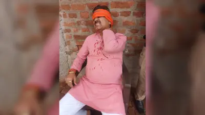 हादसे में भाजपा जिलाध्यक्ष समेत चार घायल