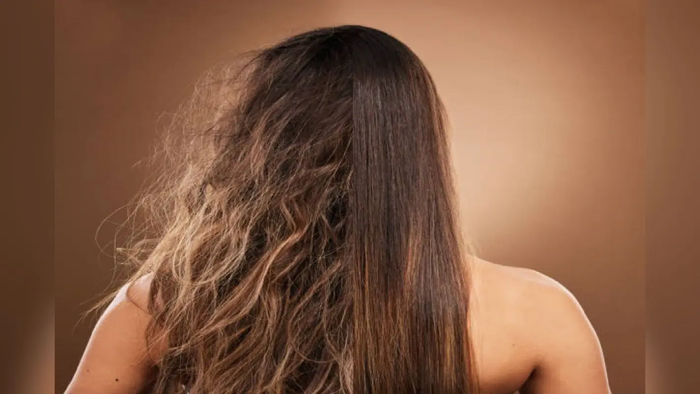 Monsoon Hair Care: बार-बार कंघी करने पर भी उलझते हैं बाल, जानिए क्या है उपाय
