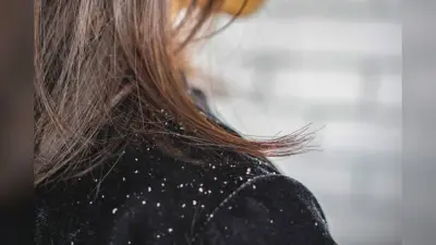 Hair Care Tips: क्या बालों में तेल लगाने से बढ़ती है रूसी की समस्या ?