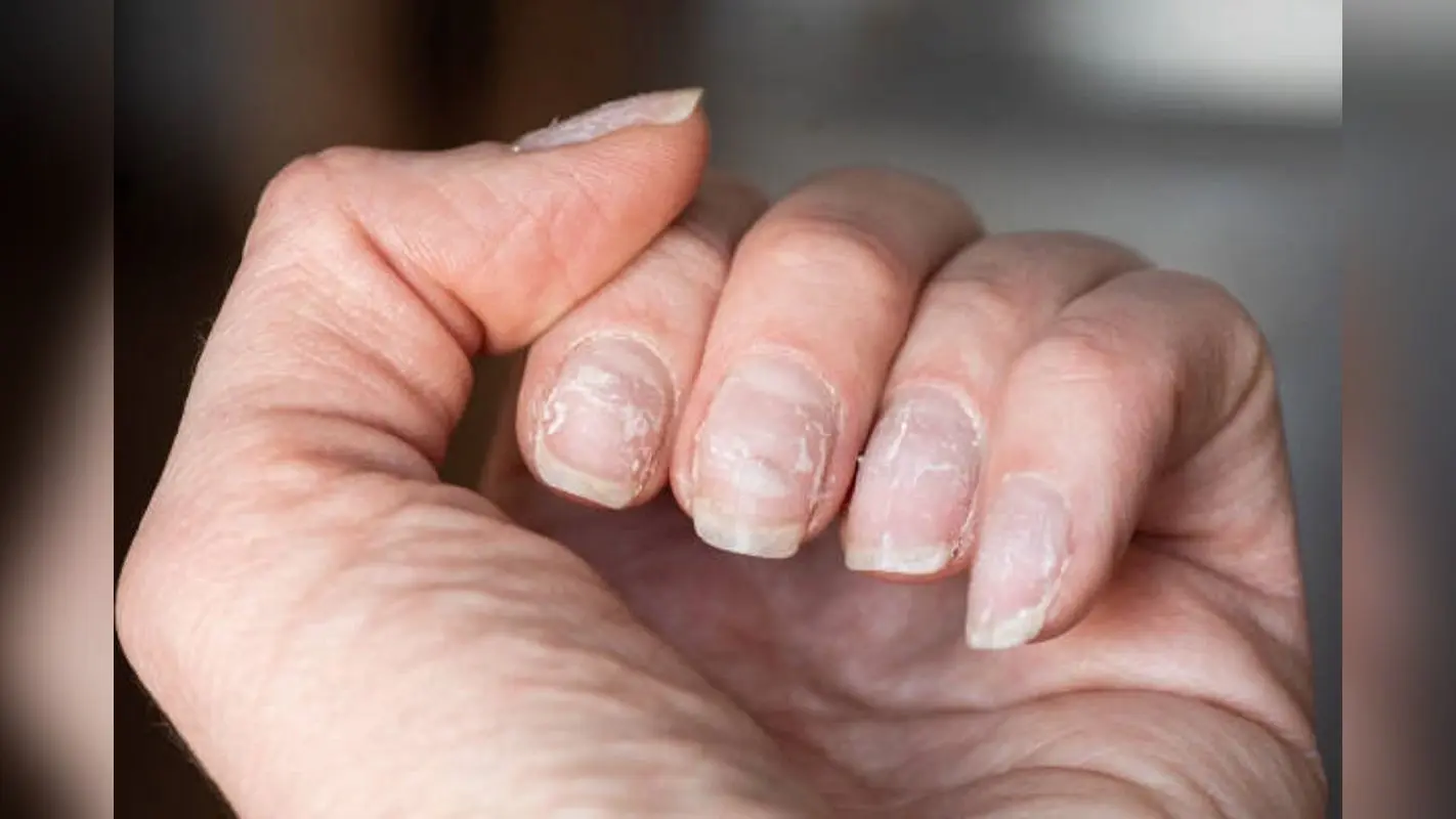 Nail Care: ये संकेत बताते हैं कि आपके नाखूनों को देखभाल की जरूरत है