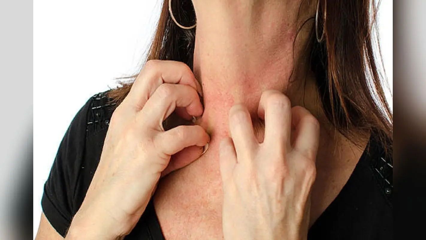 Monsoon Skin Care: बारिश के मौसम में होनी वाली स्किन ऐलर्जी से बचने के लिए फॉलो करें ये तरीके