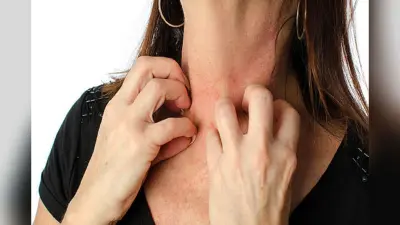 Monsoon Skin Care: बारिश के मौसम में होनी वाली स्किन ऐलर्जी से बचने के लिए फॉलो करें ये तरीके