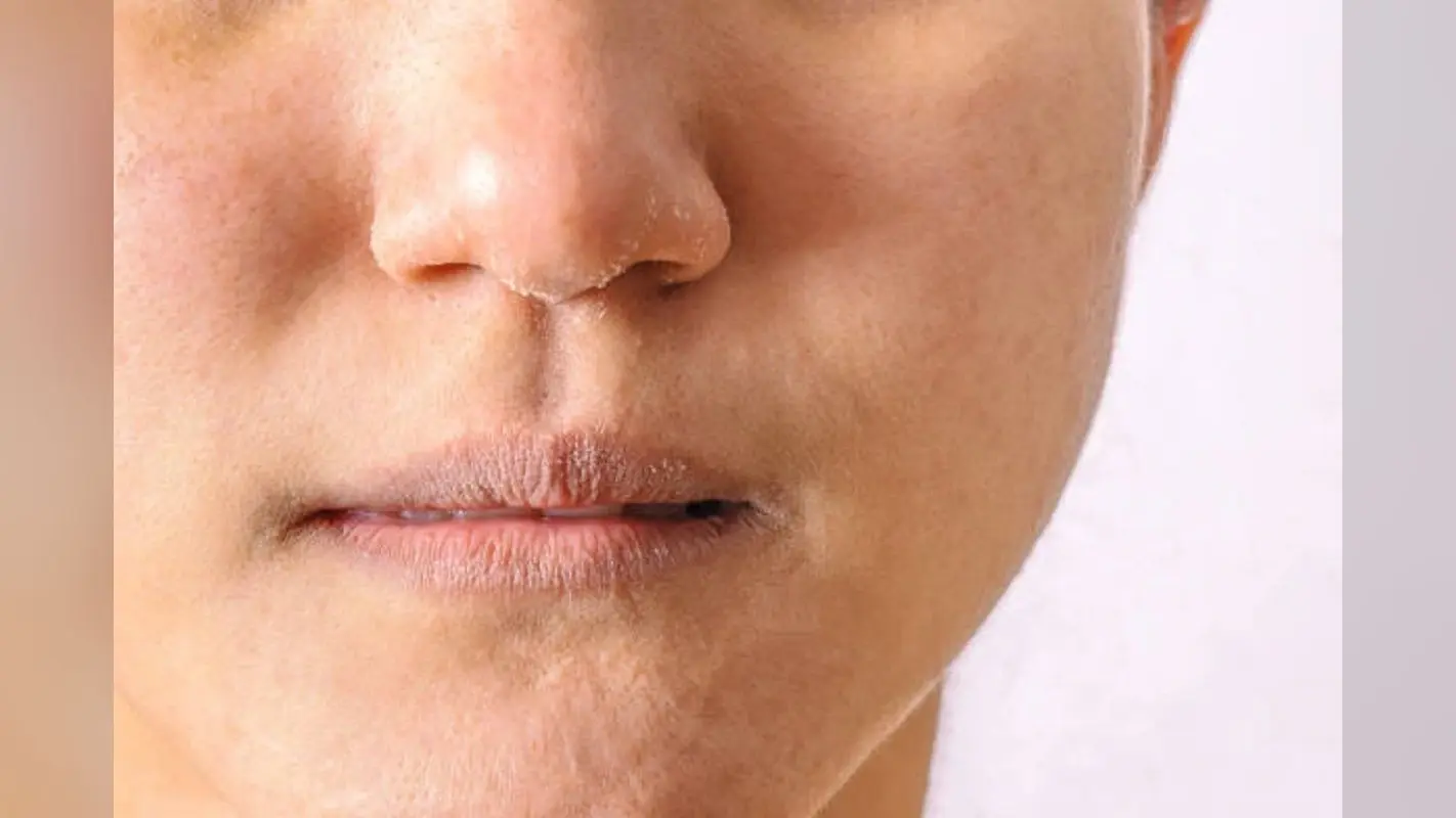 Lip Care: मानसून में होंठ दिखतें हैं खुरदरे और पीले, इन तरीकों से होगा फायदा