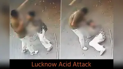Lucknow Acid Attack: युवती पर एसिड अटैक के बाद भाई बोतल से डालता रहा पानी