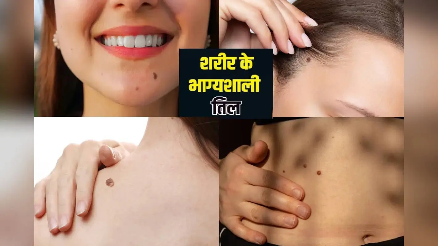 Significance Of Moles : अगर आपकी बॉडी में इन जगहों पर हैं तिल, तो जल्द चमकेगा किस्मत का सितारा