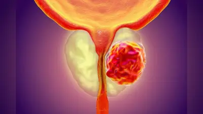 Prostate Cancer : पुरुषों में प्रोस्टेट ग्रंथि से जुड़ी समस्याओं के यह होते हैं लक्षण, नजरअंदाज करना पड़ सकता है भारी