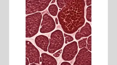 Sarcoma: सारकोमा: एक गंभीर लेकिन दुर्लभ कैंसर