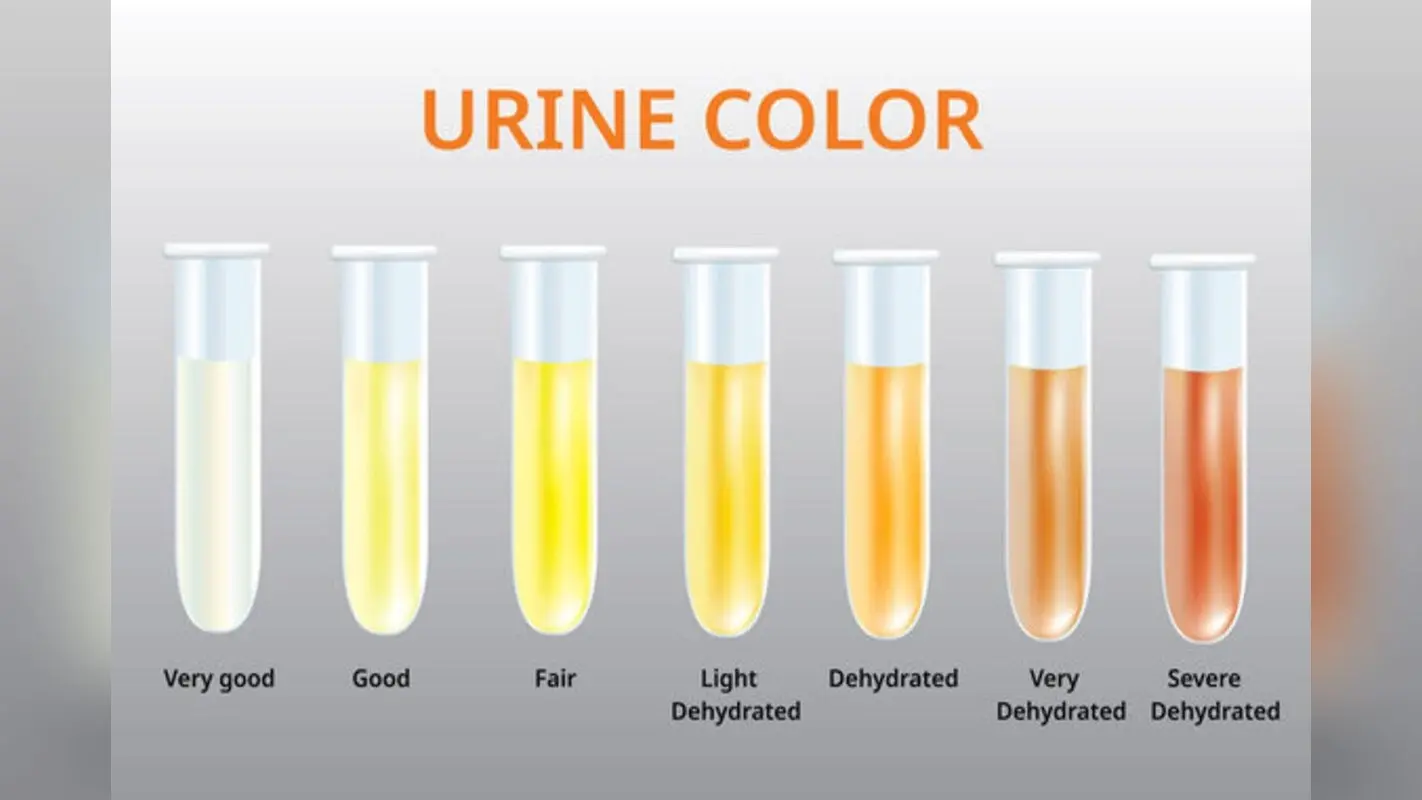 What is your Urine Color? :क्या पेशाब के रंग से पता चलता है शरीर में हाइड्रेशन का लेवल?