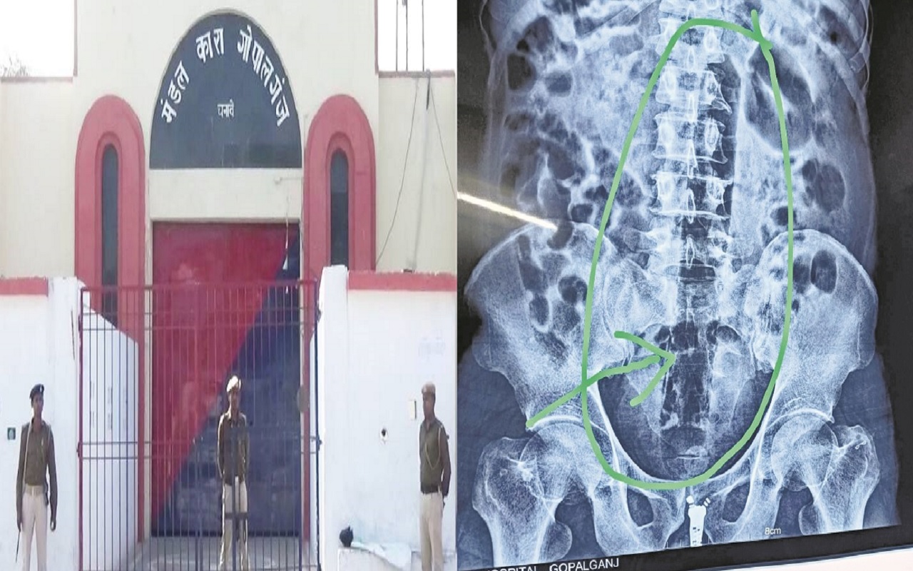 बिहार की जेल में कैदी ने गुप्तांग में डाल लिया पाइप, पेट में फंसी, डॉक्टर भी रह गए दंग, जानिए पूरा मामला…
