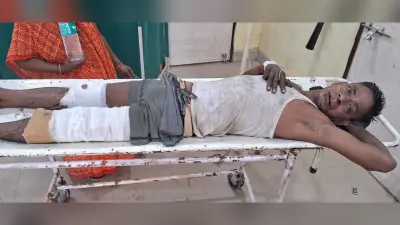 वाहनों की टक्कर में टैंकर चालक घायल, सदर अस्पताल ने किया रेफर