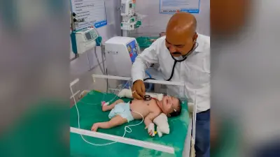 CPAP machine for newborn treatment: एसएनसीयू में सीपैप मशीन से नवजात मृत्यु दर में आएगी कमी, श्वसन समस्याओं के उपचार में मिलेगी राहत
