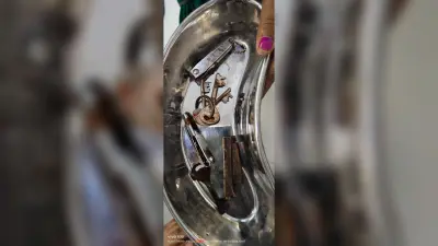 बिहार के मोतिहारी में युवक के पेट से निकला चाभी का गुच्छा, चाकू व नेलकटर