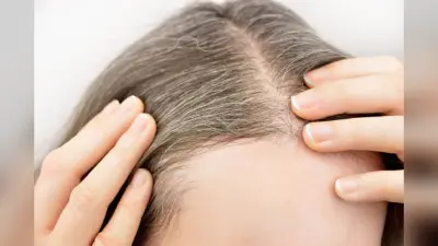 Monsoon Hair Care: बरसात में बालों को झड़ने से रोकने के लिए फॉलो करें ये टिप्स