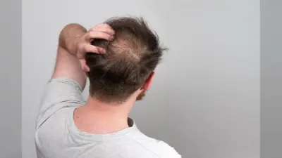 Monsoon Hair Care for Men: अपने बालों को झड़ने से रोकने के लिए फॉलो करें ये टिप्स