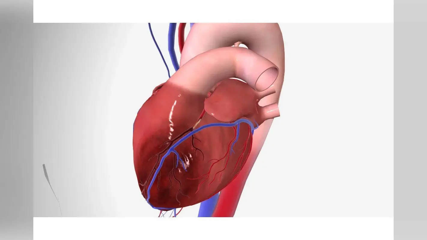 Myocarditis remedies: मायोकार्डिटिस के लिए घरेलू उपचार और देखभाल के उपाय