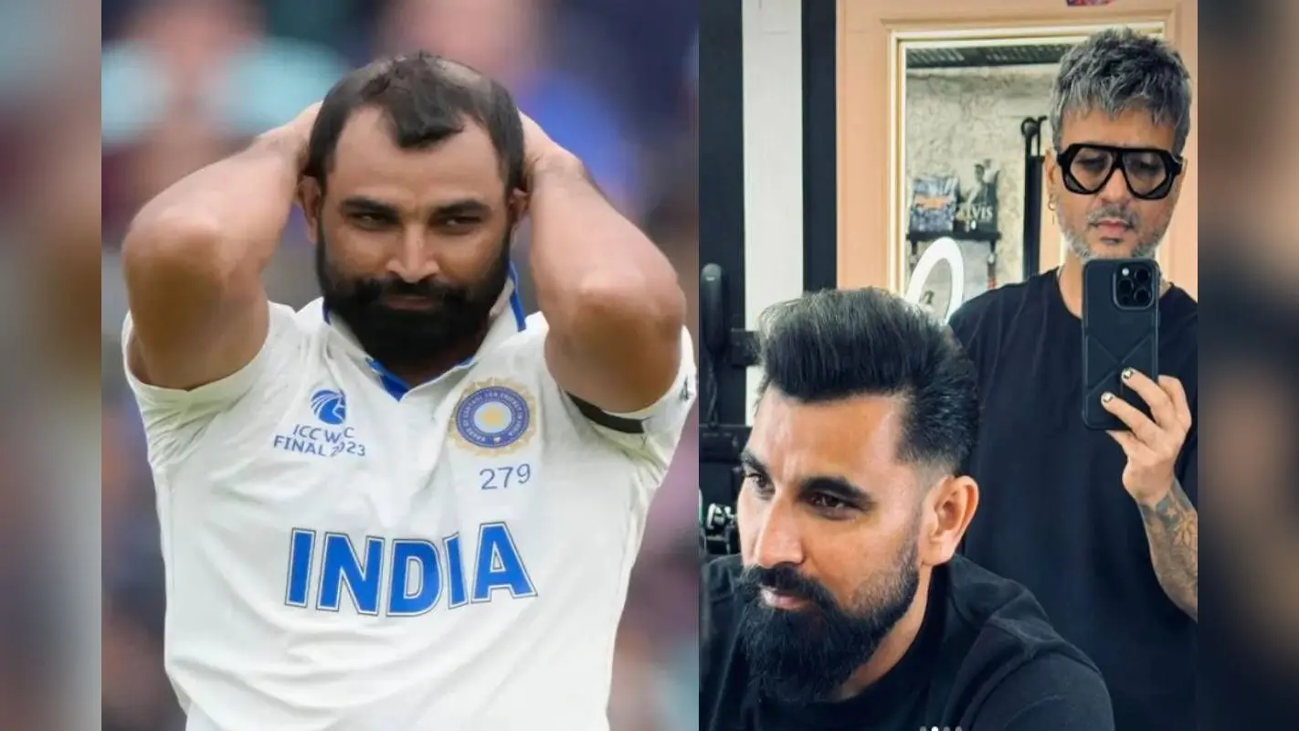 Hair Transplant: क्रिकेटर मोहम्मद शमी के नए बाल उगते ही बदला लुक, जानें कैसे और कितना आया खर्च