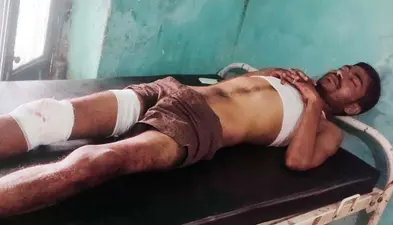 ऑटो पलटने से तीन व्यक्ति जख्मी, अन्य की स्थिति नाजुक, रेफर