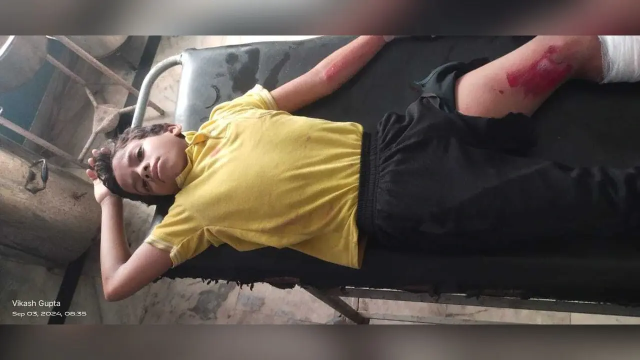 Accident news: टेंपो पलटी, एक दर्जन स्कूली बच्चे जख्मी