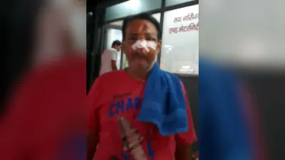 पिस्टल की बट से मारकर लूट ली चेन, रिटायर्ड इंजीनियर के नाक की हड्डी टूटी