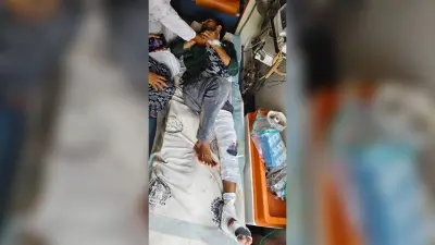 दो बाइक की आमने-सामने टक्कर, दोनों चालक हुआ गंभीर, रेफर