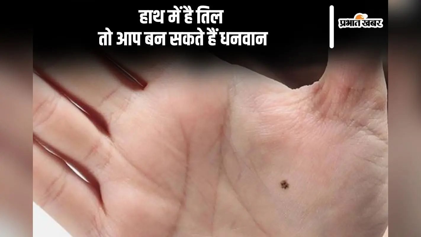 Lucky Mole: होंठ, नाक और माथे पर तिल होने का क्या है मतलब, जानें कितना शुभ और अशुभ है ये तिल