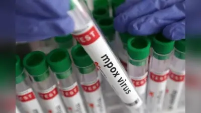 Monkeypox: देश में पांव पसार रहा मंकीपॉक्स, दिल्ली के बाद अब केरल में भी मिला केस