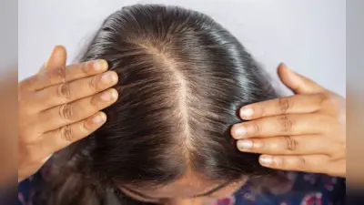 Monsoon Hair Care: शैम्पू के बाद भी चिपचिपे लगते हैं बाल? इन तरीकों से दूर होगी समस्या