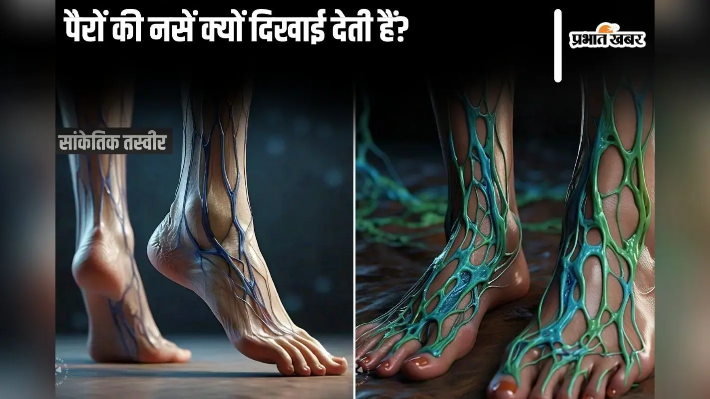 Visible Leg Veins: पैरों की नसें क्यों दिखाई देती हैं?