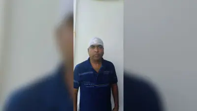 सीओ को ई-रिक्शा ने मारी ठोकर, घायल