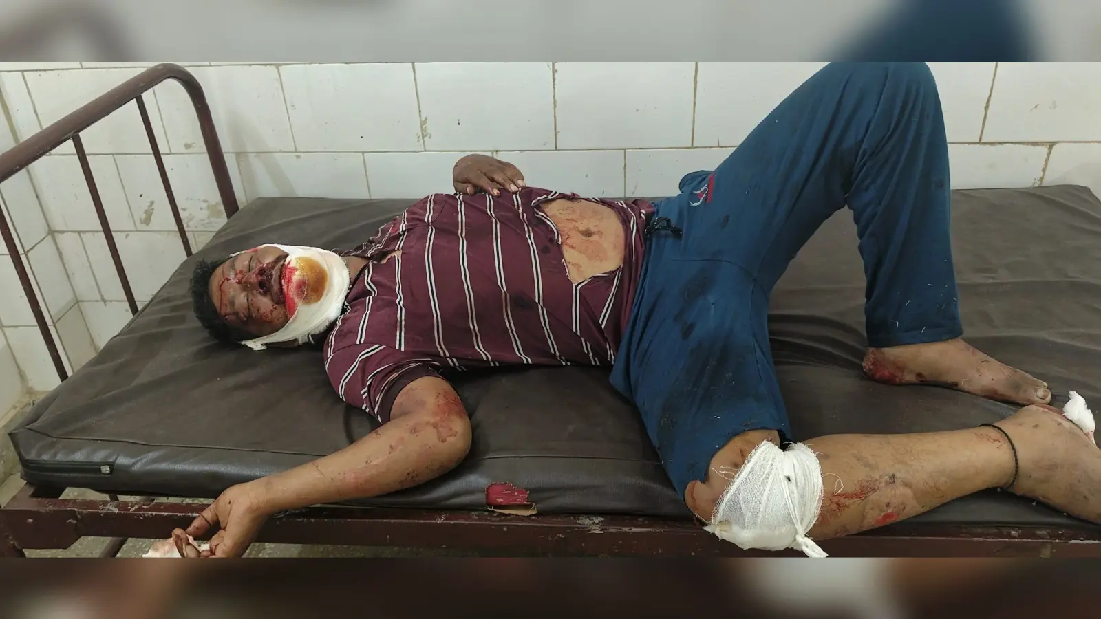 अज्ञात वाहन के धक्के से शख्स घायल, धनबाद रेफर