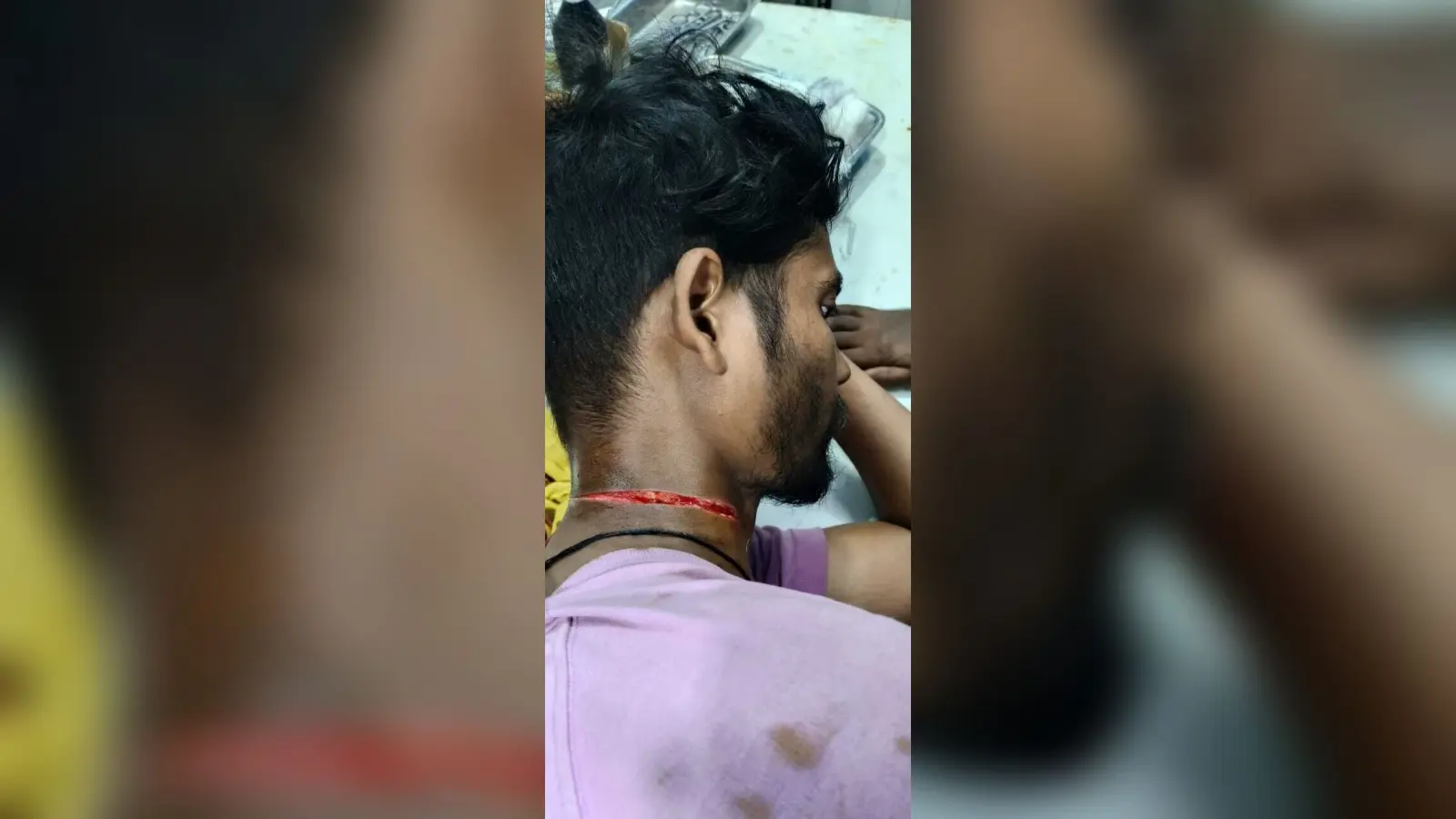 गर्दन पर धारदार हथियार से किया हमला
