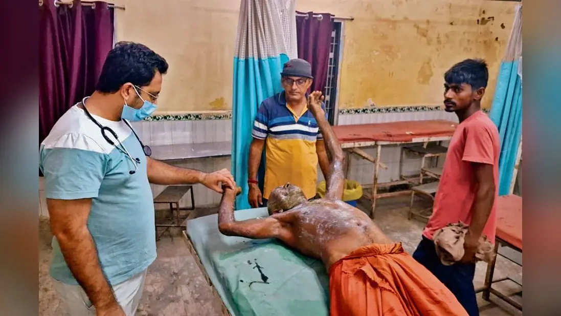 Gopalganj News : दरवाजे पर सो रहे बुजुर्ग किसान पर तेजाब से हमला, पीएमसीएच रेफर