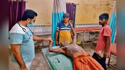 Gopalganj News : दरवाजे पर सो रहे बुजुर्ग किसान पर तेजाब से हमला, पीएमसीएच रेफर