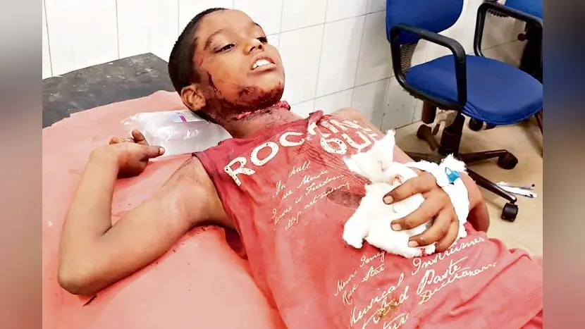DHANBAD NEWS : आपसी विवाद में पुटकी में चाकूबाजी, दो गंभीर