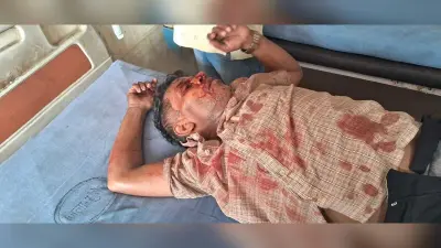 सड़क किनारे खड़ी ट्रैक्टर से टकरायी मिनी बस, चालक सहित दो घायल घायल