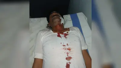 Samastipur News: बाइक सवार बदमाशों ने चाकू मारकर अधेड़ को किया जख्मी