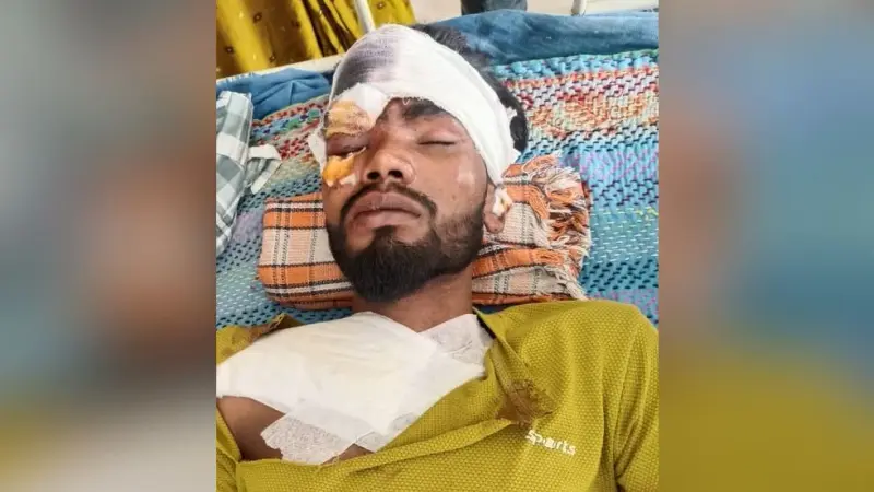 टेंपो से टक्कर में बाइक सवार दो घायल, अन्य गंभीर