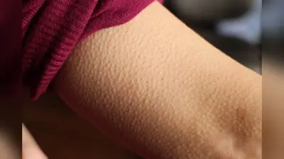 Goosebumps: ठण्डे या भावुक होने पर क्यों खड़े हो जाते हैं रोंगटे, जानें क्या कहता है रिपोर्ट