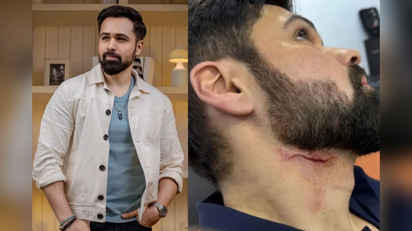 Goodachari 2: एक्शन सीन की शूटिंग के दौरान बुरी तरह जख्मी हुए Emraan Hashmi, तस्वीरें देख फैंस परेशान
