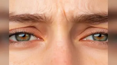 Eye Shine Remedies: आंखों की चमक क्यों हो रही है फीकी? जानें पीली आंखों का कारण और उपाय