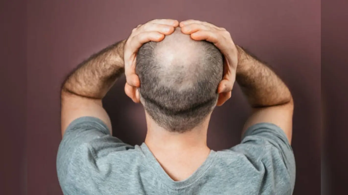 Hair Care Tips: झड़े हुए बालों को उगाने में मदद करेगा कैस्टर ऑइल, जानें इस्तेमाल करने का तरीका