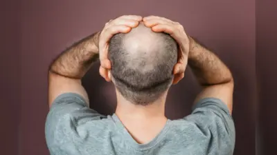 Hair Care Tips: झड़े हुए बालों को उगाने में मदद करेगा कैस्टर ऑइल, जानें इस्तेमाल करने का तरीका