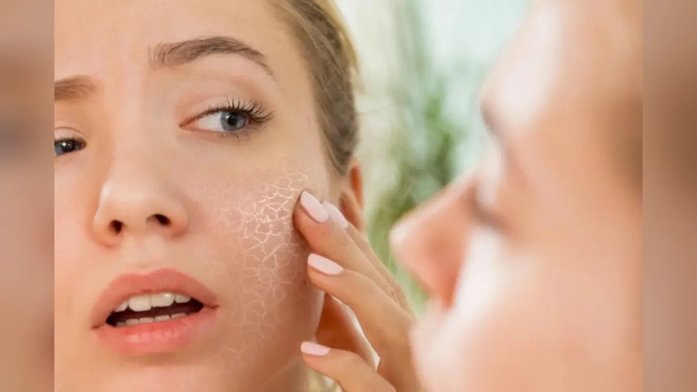 Tips For Dry Skin Care In Winters: सर्दी में रुखेपन के कारण हो रही है असुविधा तो अपनाएं ये टिप्स