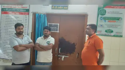 सदर अस्पताल में सीटी स्कैन के बाद मरीजों को नहीं मिल रहा फिल्म प्लेट