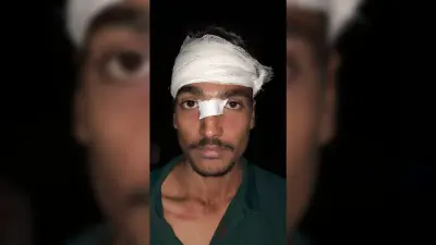 Dhanbad News : युवकों ने दुकानदारों को पीटा, ग्राहक का सिर फोड़ा