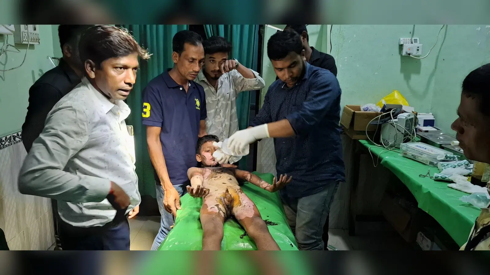 बच्चे के पॉकेट में रखा बम हुआ ब्लास्ट, दादा-पोता जख्मी
